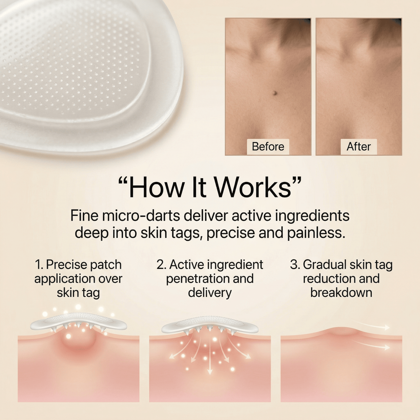 DermaSmooth - Skin Tag & Mole Remover Patches