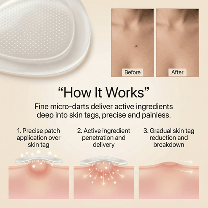 DermaSmooth - Skin Tag & Mole Remover Patches